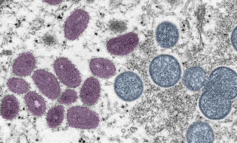 Monkeypox ist vorerst kein globaler Gesundheitsnotfall, sagt die WHO